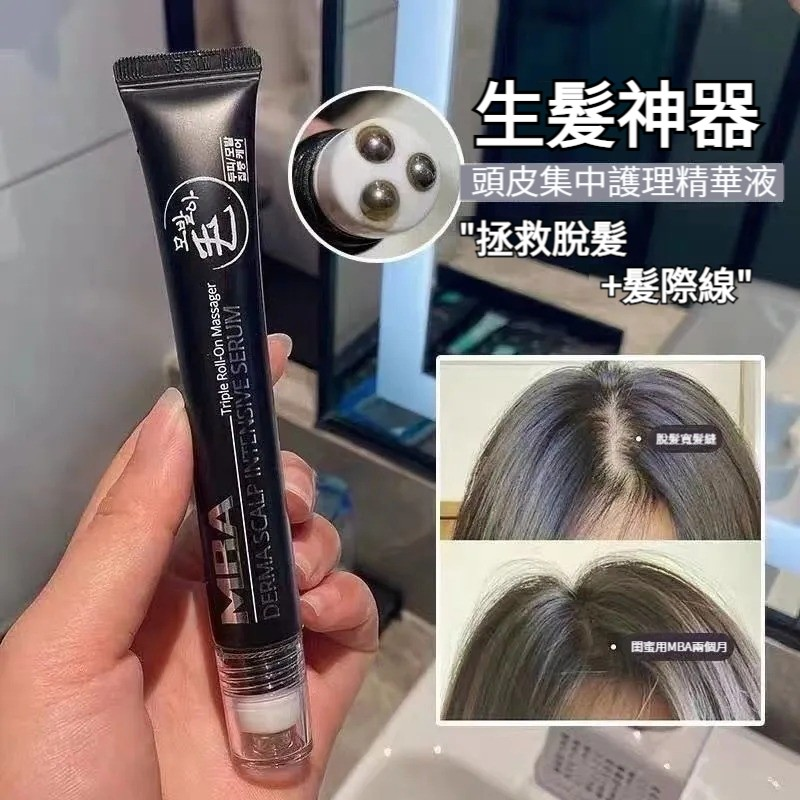 終於不禿了，碎髮爆炸！ 韓國熱銷 #防脫滾珠生發液，拯救禿頭少女 週期使用，效果更佳，大牌明星都在用！