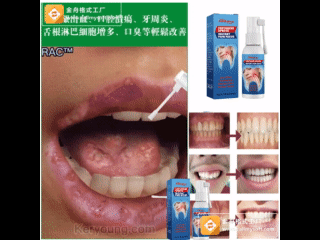 熱賣【牙周炎輕鬆治療】草本精華，專攻牙痛，不拔牙不開刀，一噴止痛，消除牙痛/牙周炎/牙齦腫痛等口腔問題